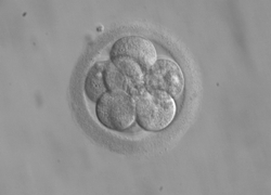 Normal_embryo