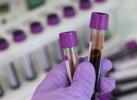 Normal_lab__bloed__laboratorium